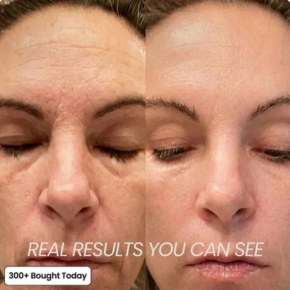 🔥LAST DAY 60% OFF  Korean Pink Collagen Volume Multi Balm