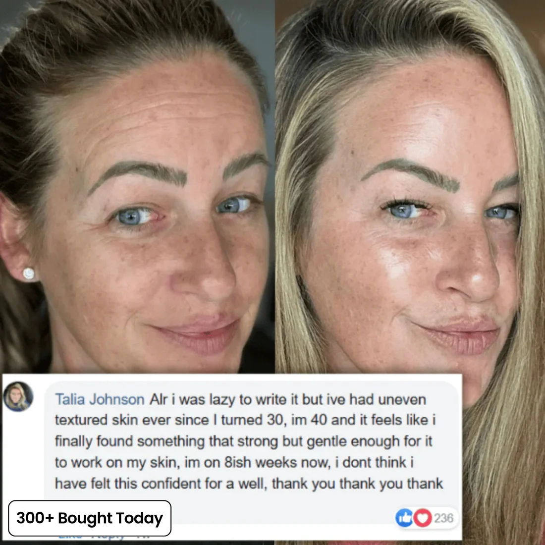 🔥LAST DAY 60% OFF  Korean Pink Collagen Volume Multi Balm