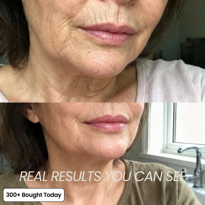 🔥LAST DAY 60% OFF  Korean Pink Collagen Volume Multi Balm