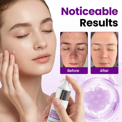 kydmer® SpotErase Probiotic Shield Serum