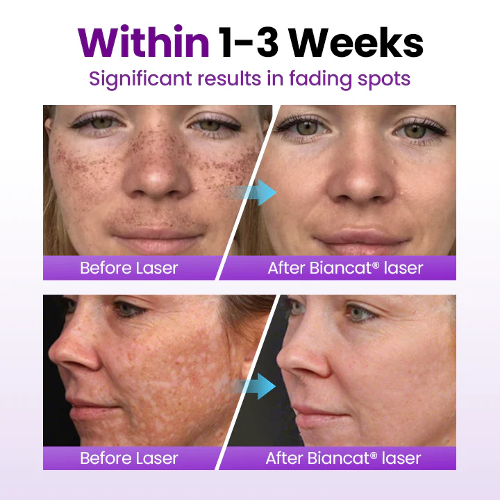 kydmer® SpotErase Probiotic Shield Serum