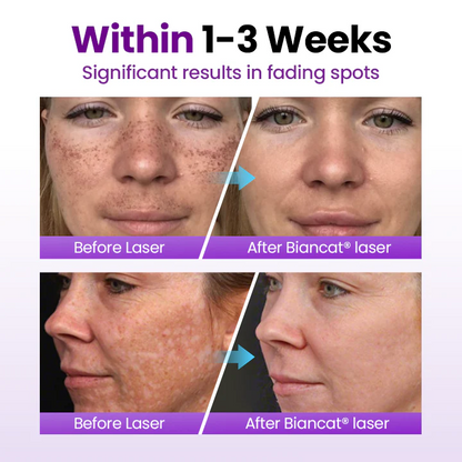 kydmer® SpotErase Probiotic Shield Serum