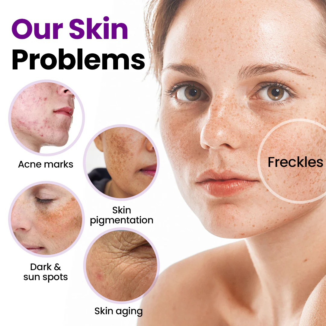 kydmer® SpotErase Probiotic Shield Serum